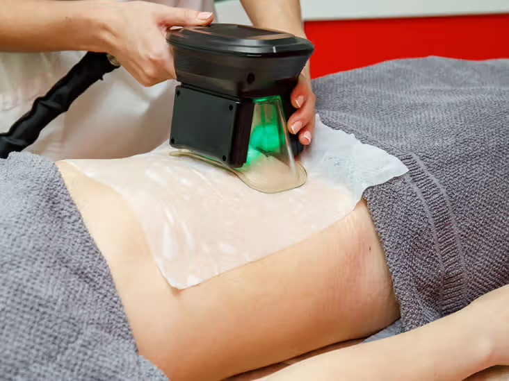 Fat Freezing vs Laser Lipo: Which Is Better